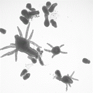 Рис. 3. Планулы гидромедузы Sarsia tubulosa и прорастание их в полип (фото З.А. Романовой) 